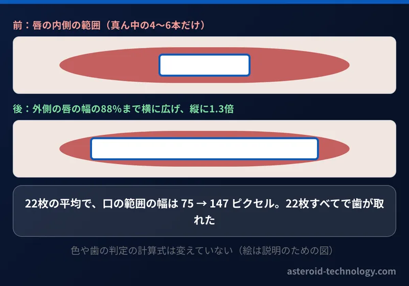 口の範囲を広げる前と後の図。内側の唇の範囲は真ん中の4〜6本だけだったが、外側の唇の幅の88%まで広げると全部の歯が入る
